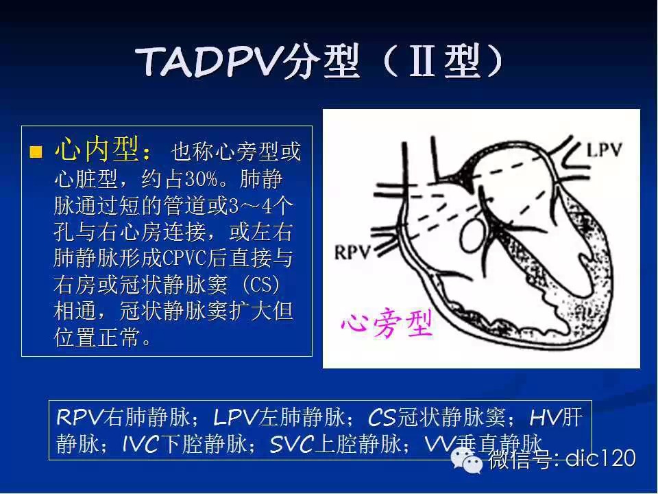 肺静脉畸形引流