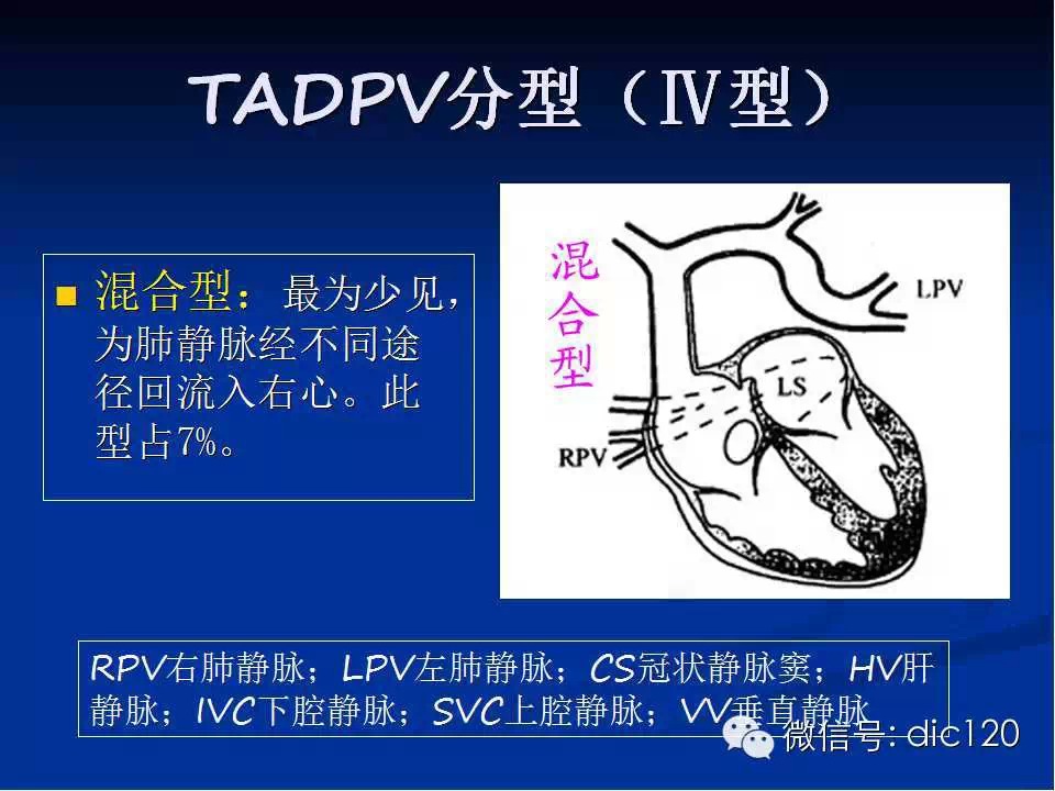 肺静脉畸形引流