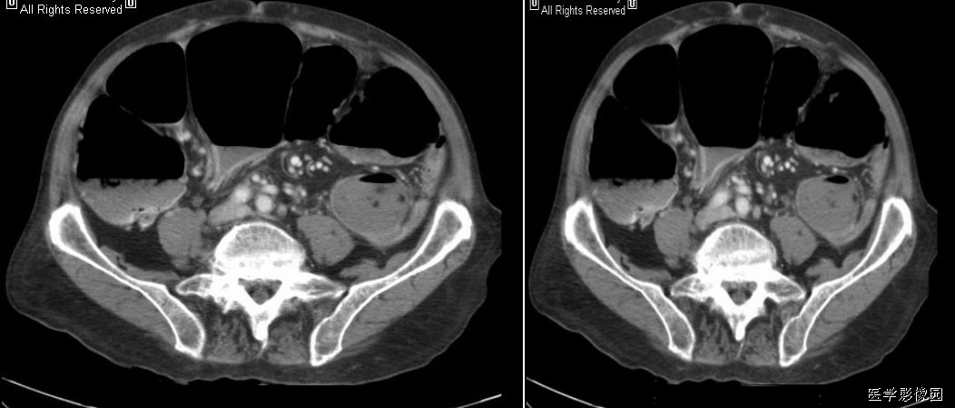 jpg