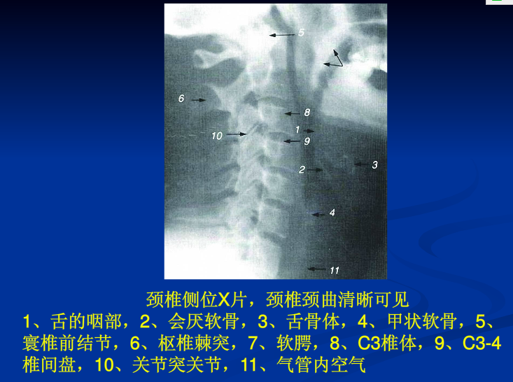 脊柱影像阅读入门