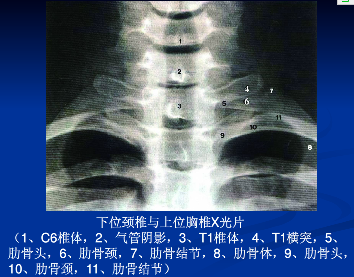 脊柱影像阅读入门