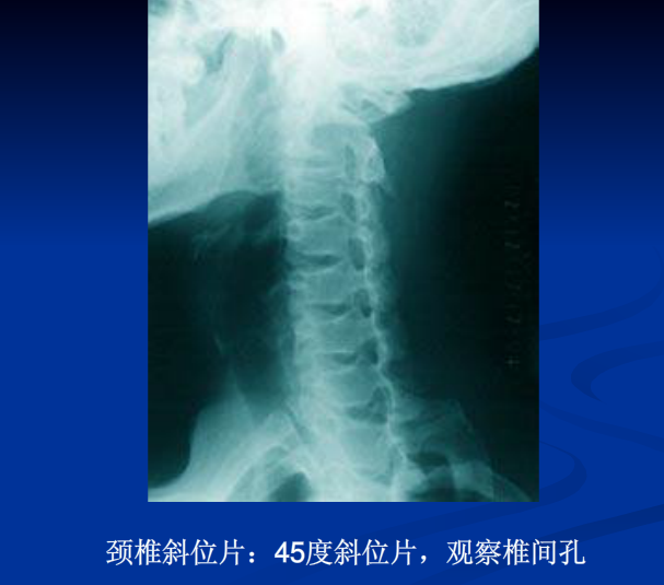 脊柱影像阅读入门