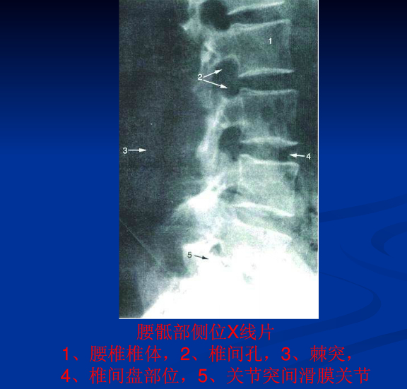 脊柱影像阅读入门