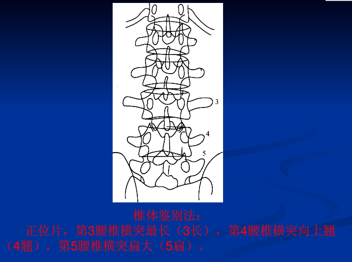 脊柱影像阅读入门
