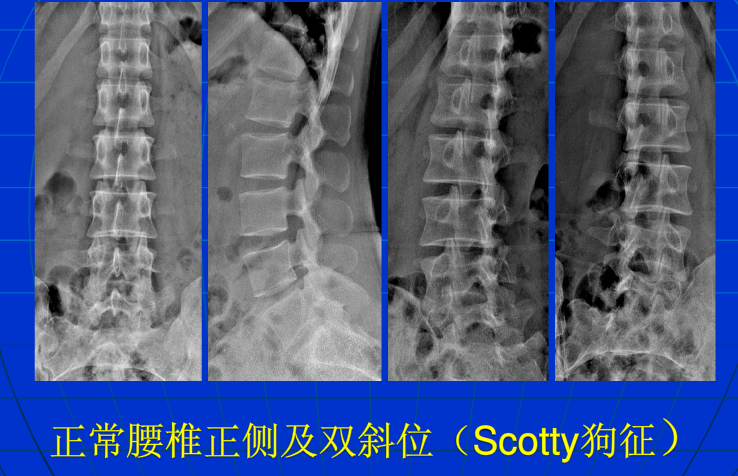 脊柱影像阅读入门