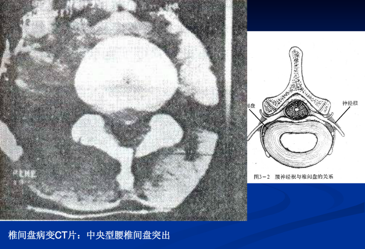 脊柱影像阅读入门
