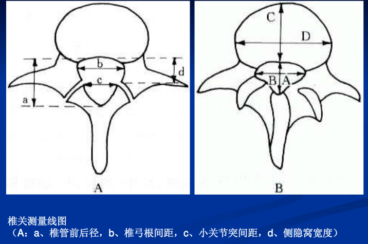 脊柱影像阅读入门