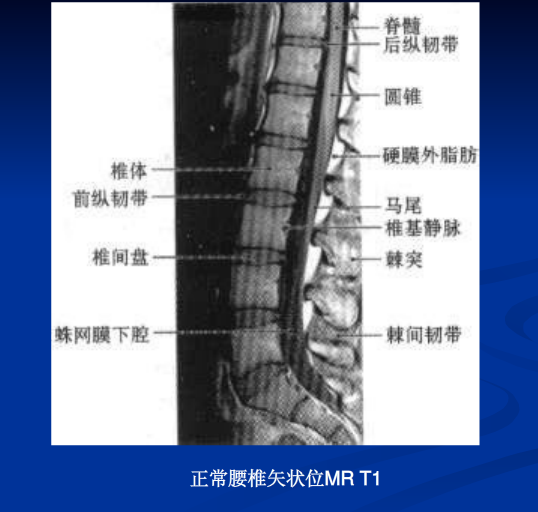 脊柱影像阅读入门