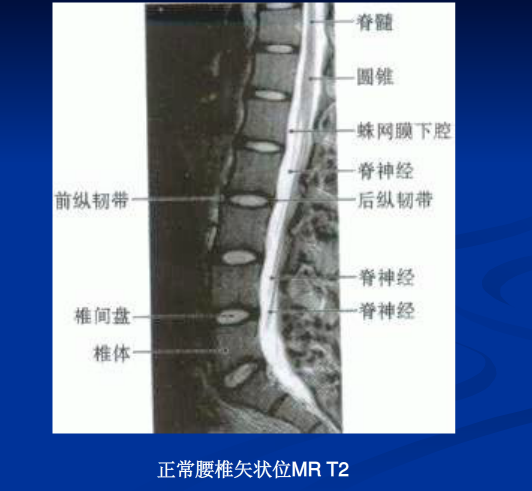 脊柱影像阅读入门