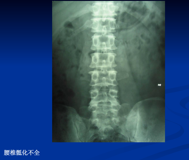 脊柱影像阅读入门