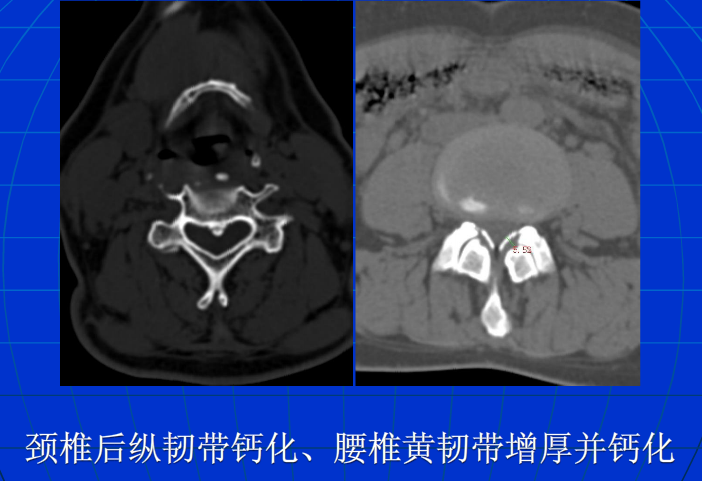 脊柱影像阅读入门