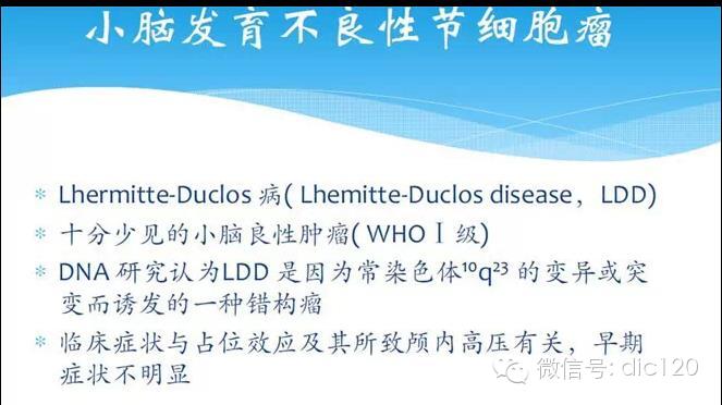 【罕见病例】小脑发育不良性神经节细胞瘤