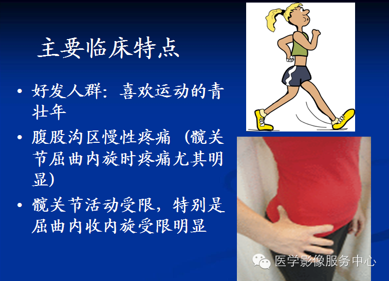髋关节撞击综合征的影像诊断