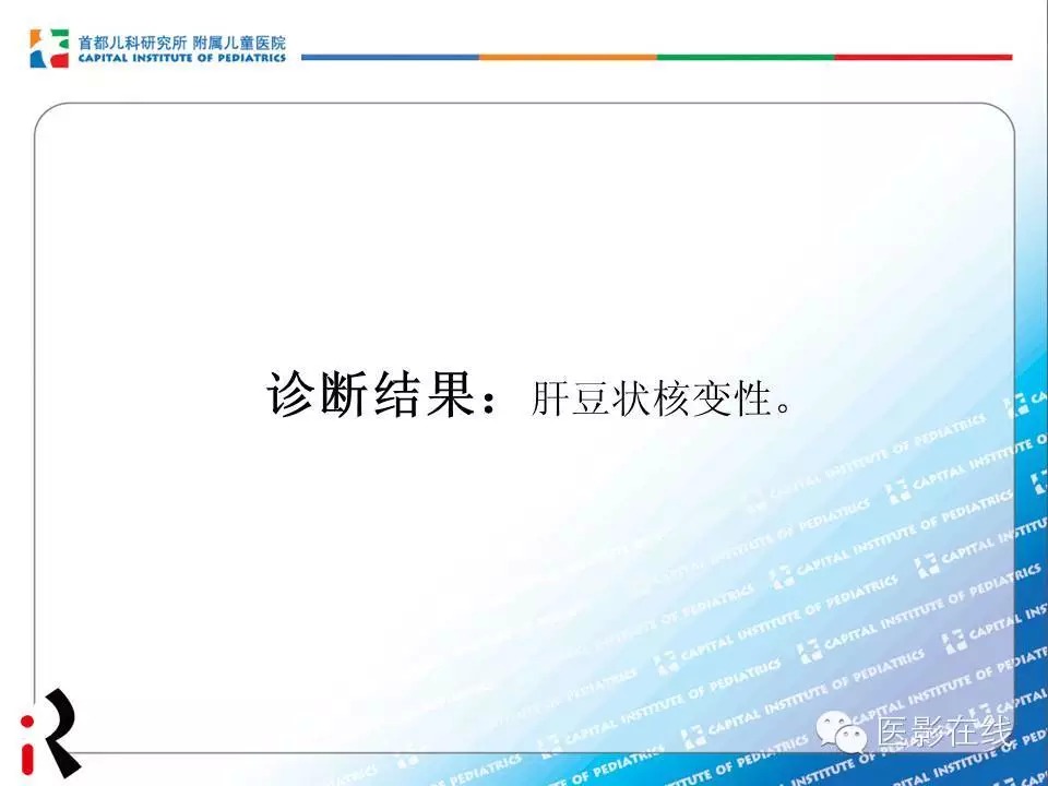 【儿科典型病例】肝豆状核变性颅脑MR一例