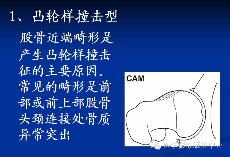 髋关节撞击综合征的影像诊断