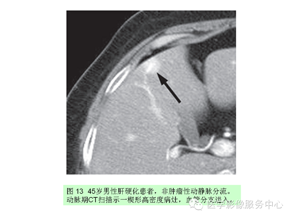 肝包膜及包膜下病变的CT及MRI表现