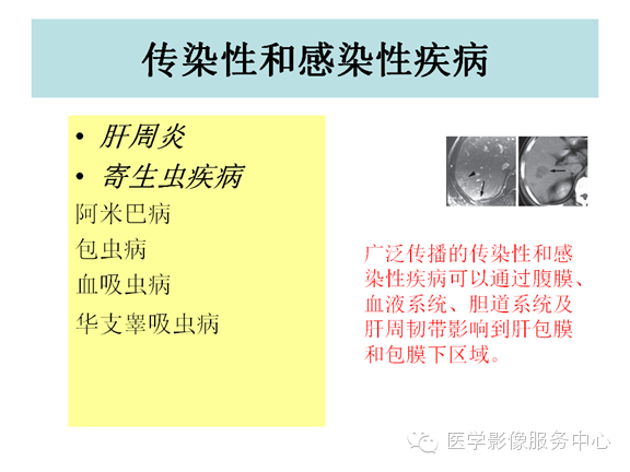 肝包膜及包膜下病变的CT及MRI表现