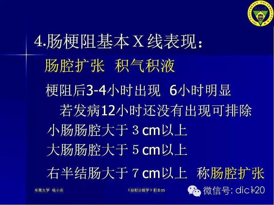 急腹症的影像学诊断