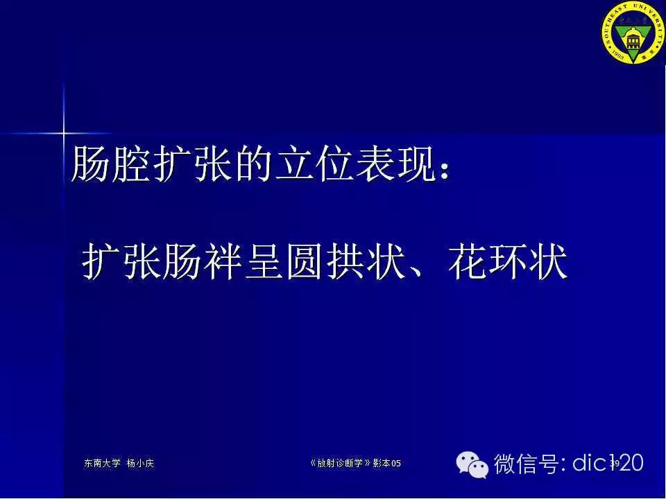急腹症的影像学诊断