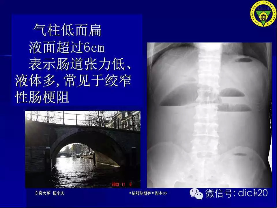 急腹症的影像学诊断