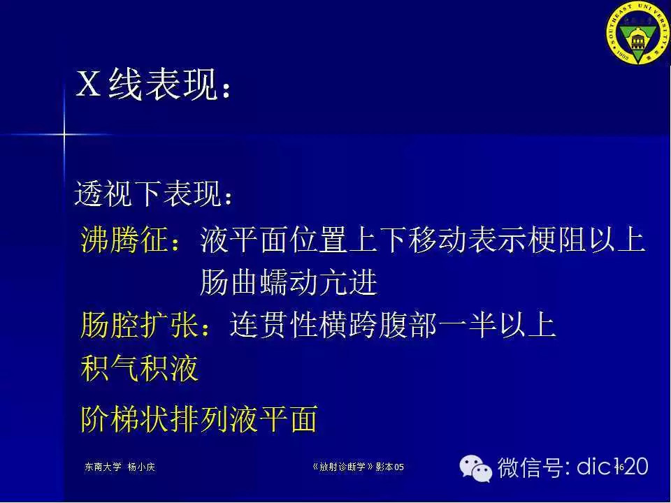急腹症的影像学诊断