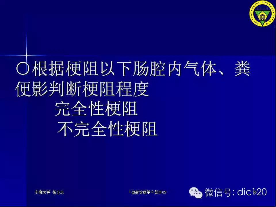 急腹症的影像学诊断