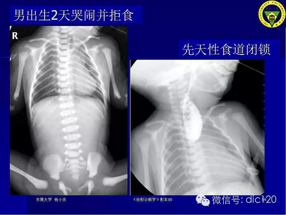 急腹症的影像学诊断
