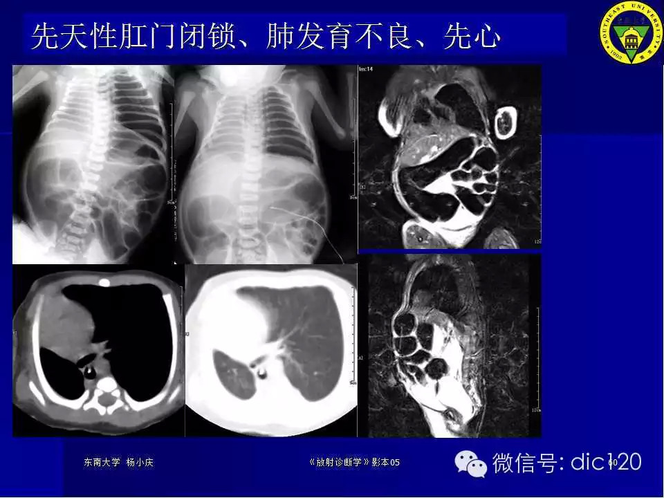急腹症的影像学诊断