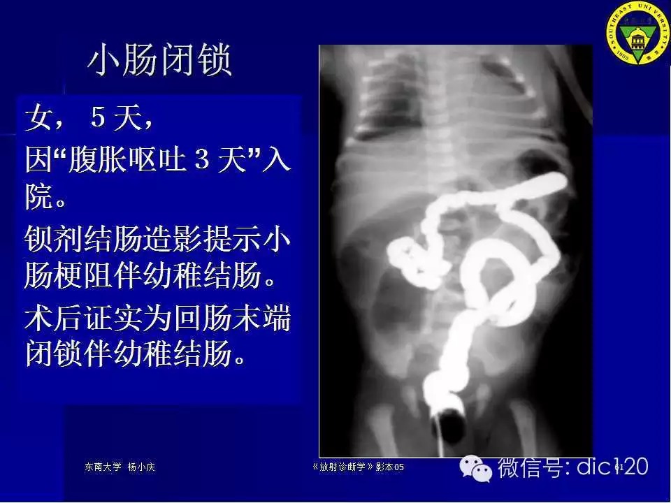 急腹症的影像学诊断