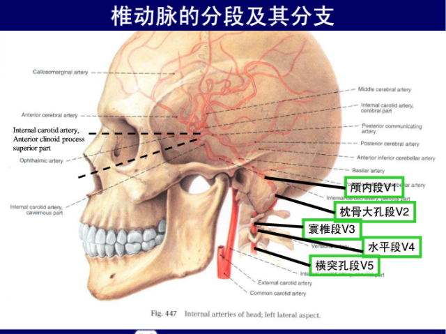 脑血管的影像解剖