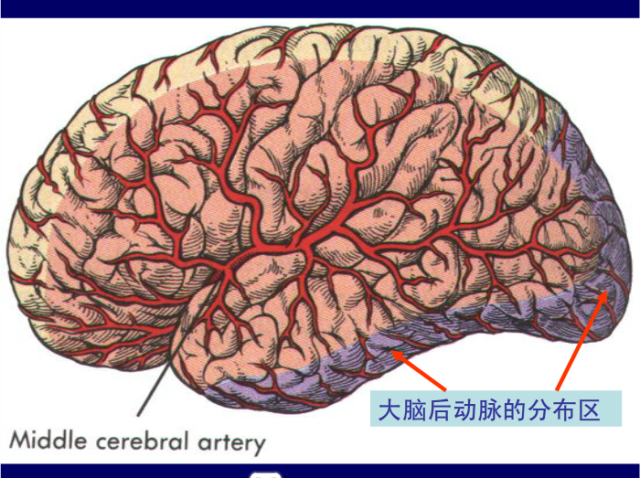 脑血管的影像解剖