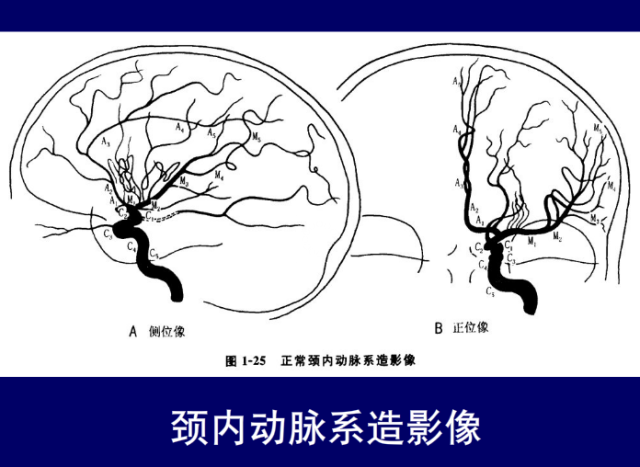 脑血管的影像解剖