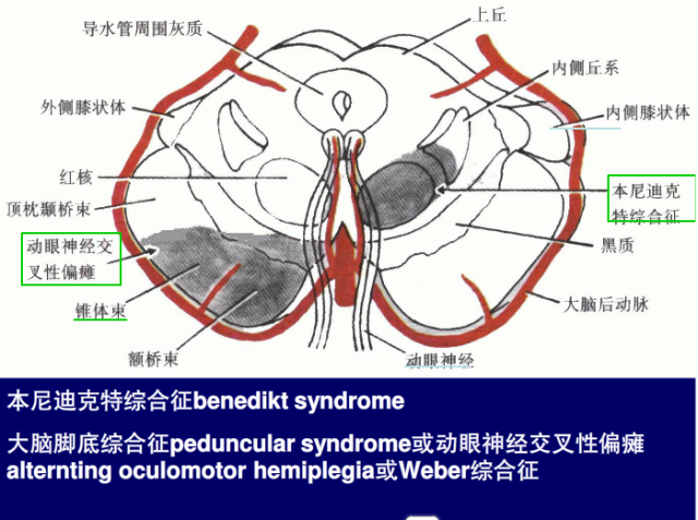 脑血管的影像解剖