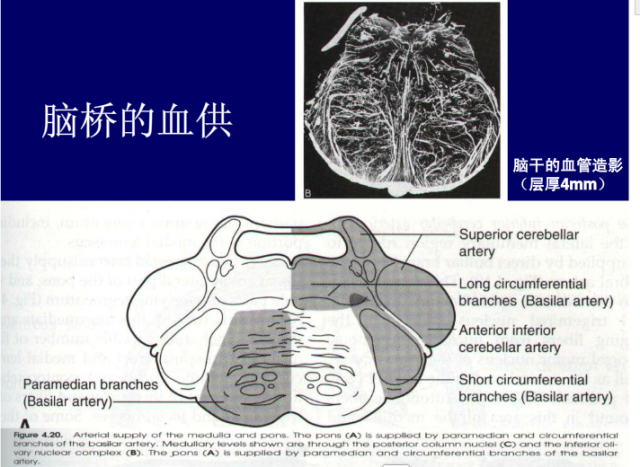 脑血管的影像解剖