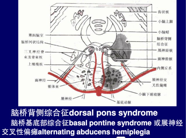 脑血管的影像解剖