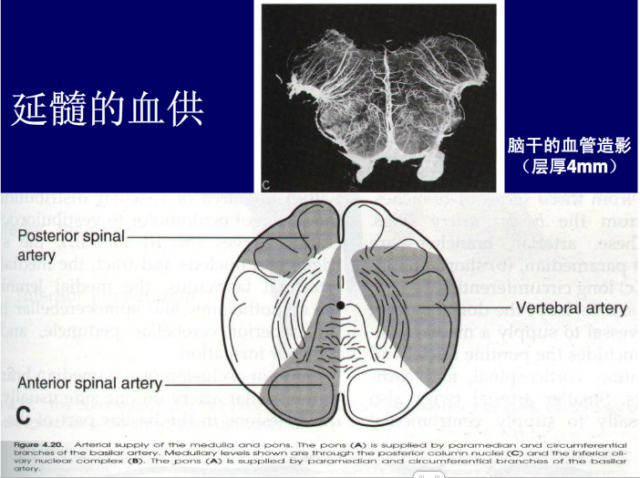 脑血管的影像解剖