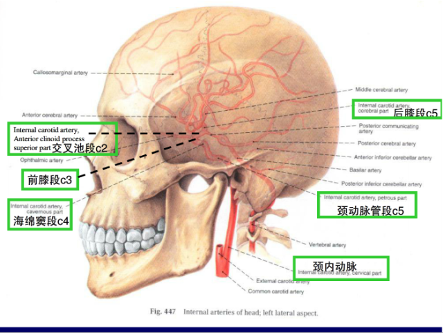 脑血管的影像解剖