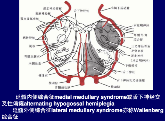 脑血管的影像解剖