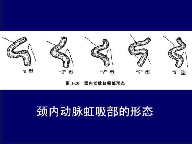 脑血管的影像解剖