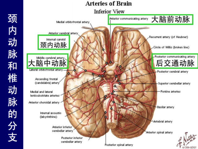 脑血管的影像解剖