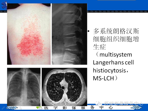 影像与临床相结合:从皮肤开始