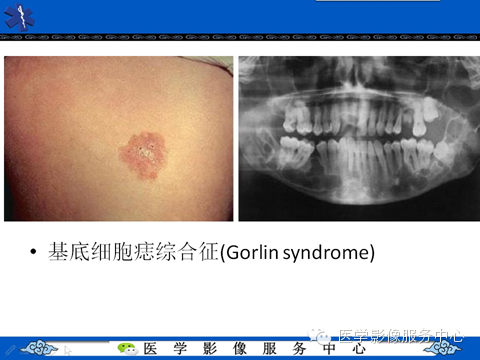 影像与临床相结合:从皮肤开始