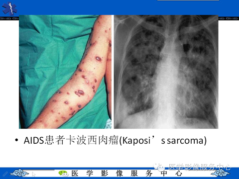 影像与临床相结合:从皮肤开始