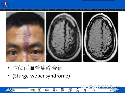 影像与临床相结合:从皮肤开始