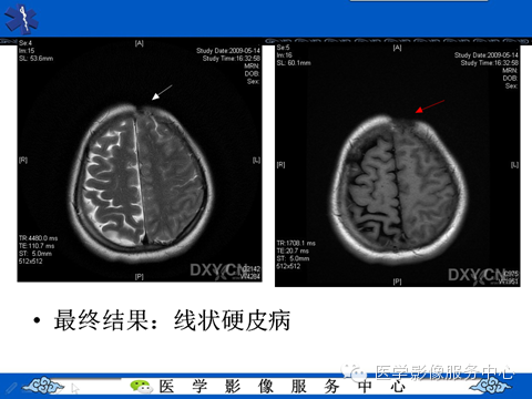 影像与临床相结合:从皮肤开始