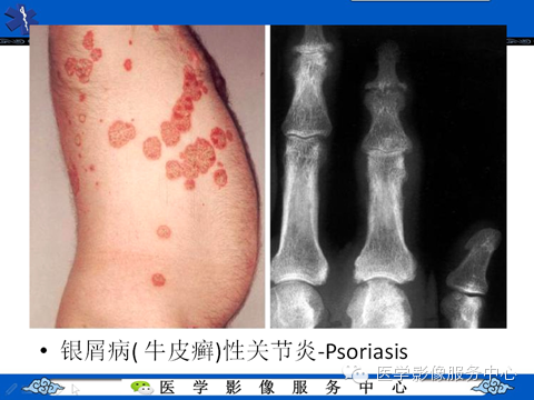 影像与临床相结合:从皮肤开始