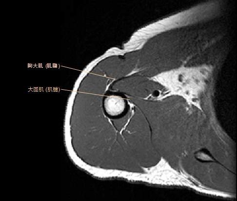 肩关节MRI解剖图谱