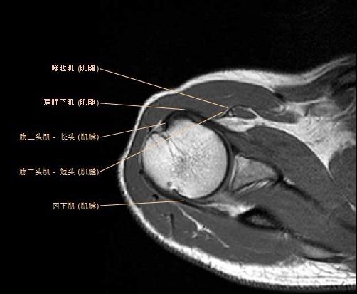 肩关节MRI解剖图谱