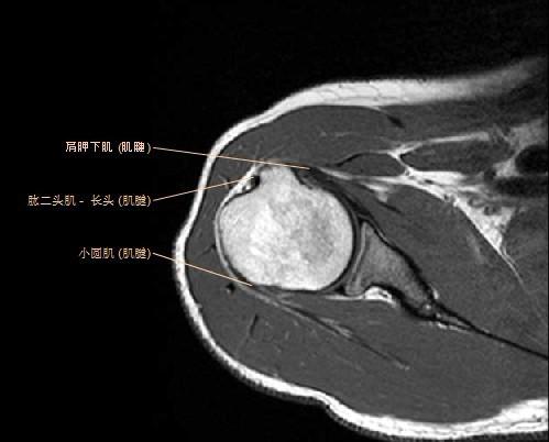 肩关节MRI解剖图谱