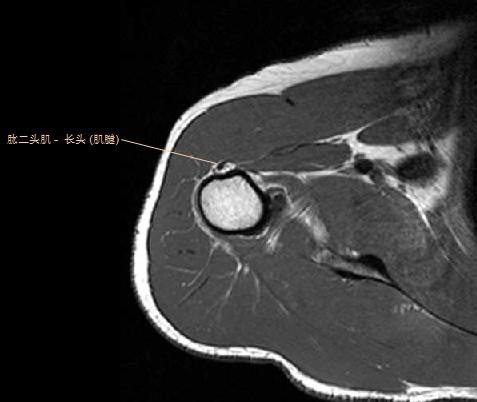 肩关节MRI解剖图谱